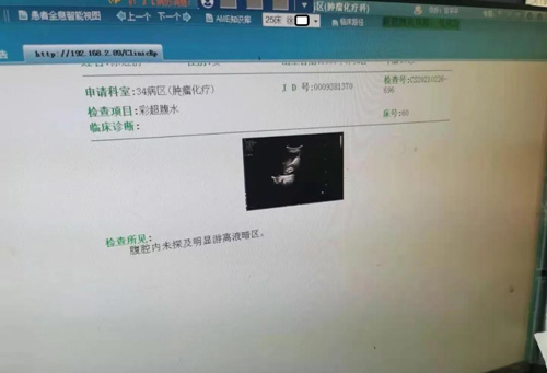 卵巢癌腹水怎么治？