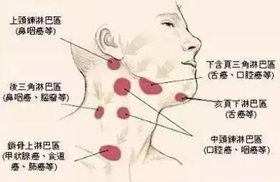 颈淋巴结核、皮肤结核特验方！