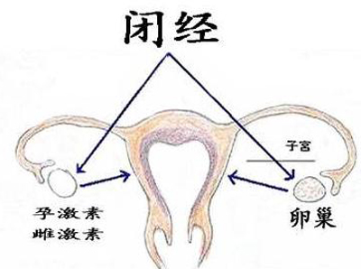 闭经