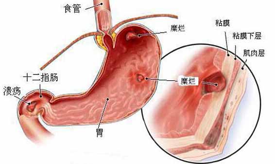 胃病 www.zgmjyxw.com